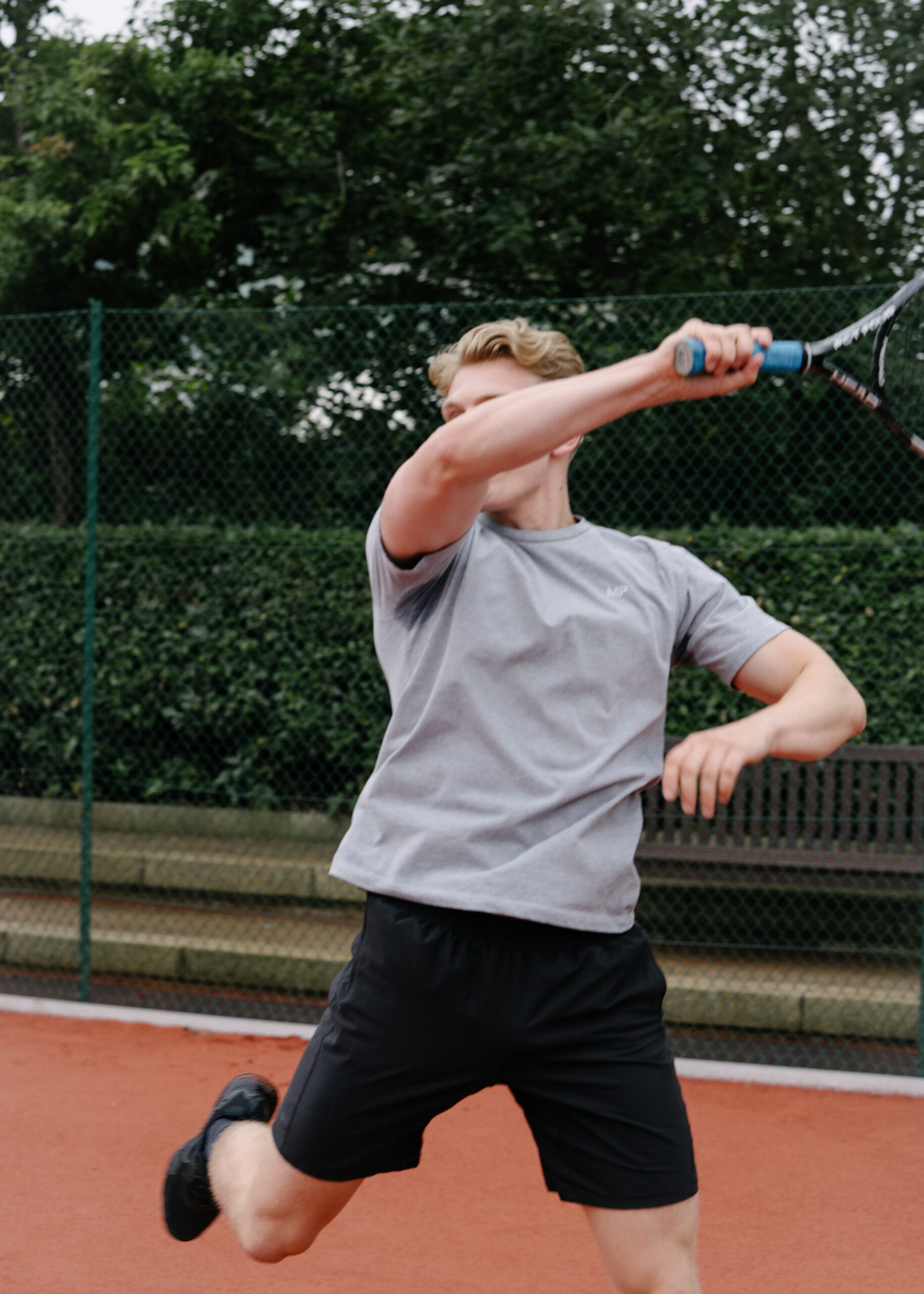 Tennis Elbow: Expert Advice for Non-Tennis Players