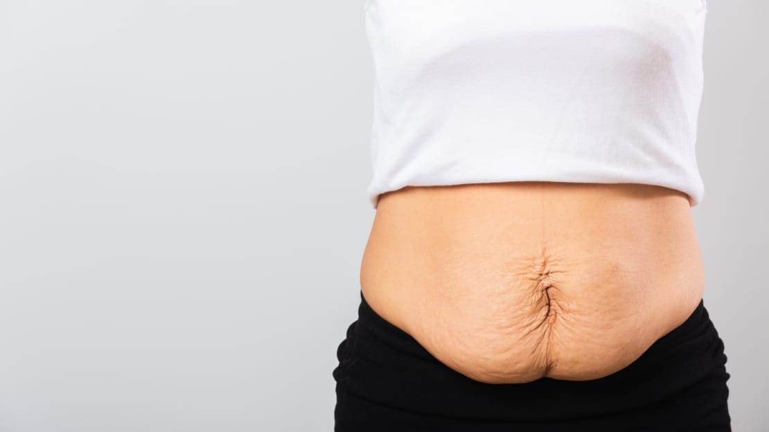 close up of post natal tummy